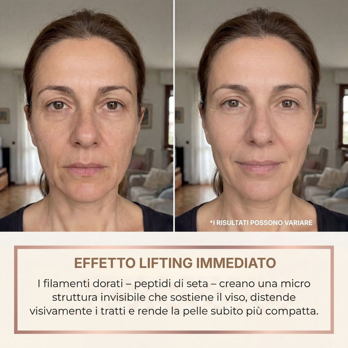 Siero antirughe prima e dopo effetto lifting immediato rughe espressione