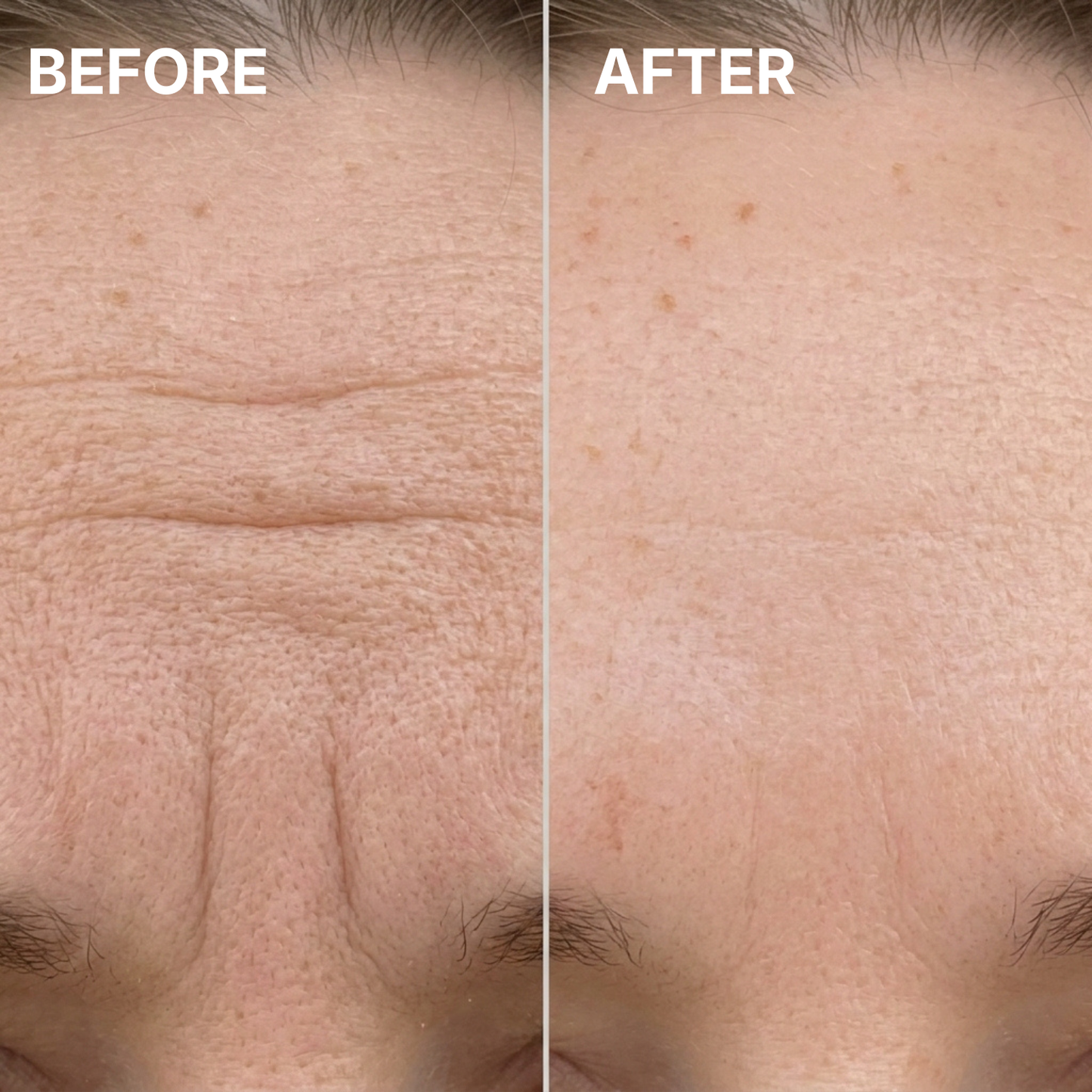 Cirevona™ Collagen Volume Multi Balm