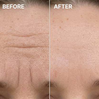 Cirevona™ Collagen Volume Multi Balm