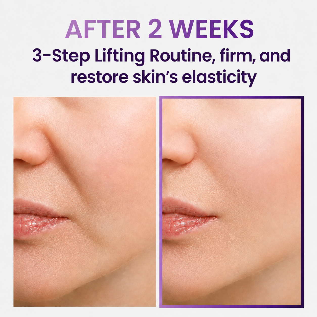 🔥 60% OFF Today Only Cirevona Premium 3-Step Firming Skincare Set