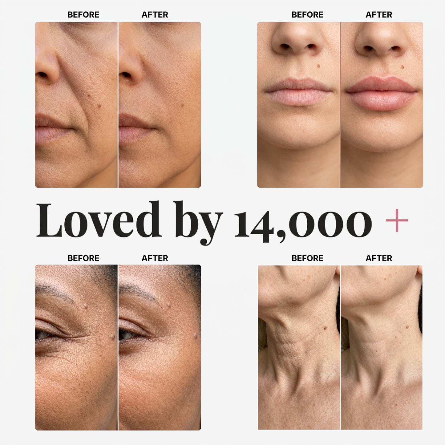 Cirevona™ Collagen Volume Multi Balm