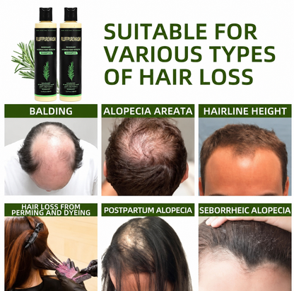 🔥LAST DAY 50% OFF - 🌿Cirevona® Organic Rosemary Hair Growth Shampoo
